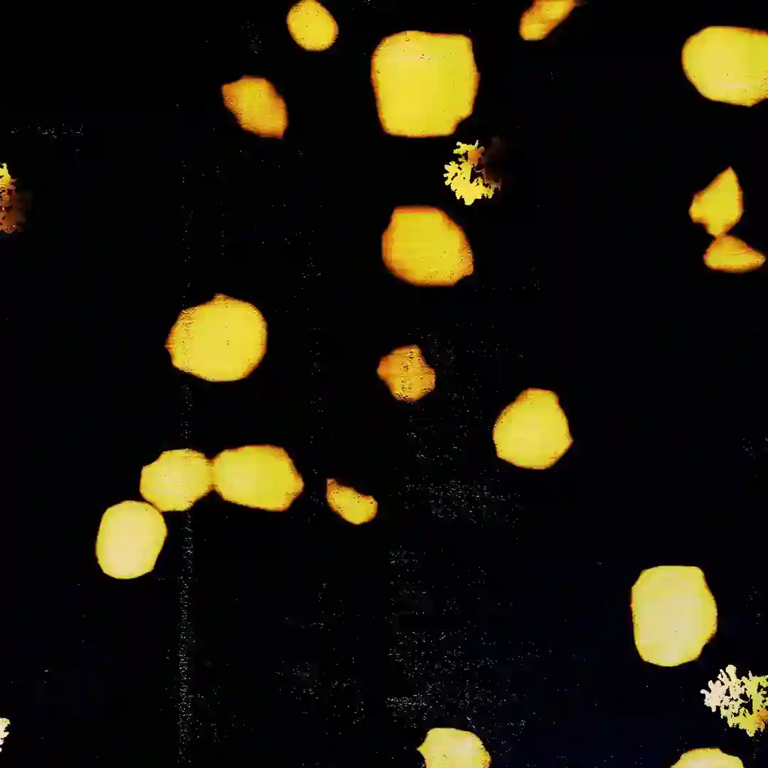 TFAM 01 ((Nørbak Remix)) cover