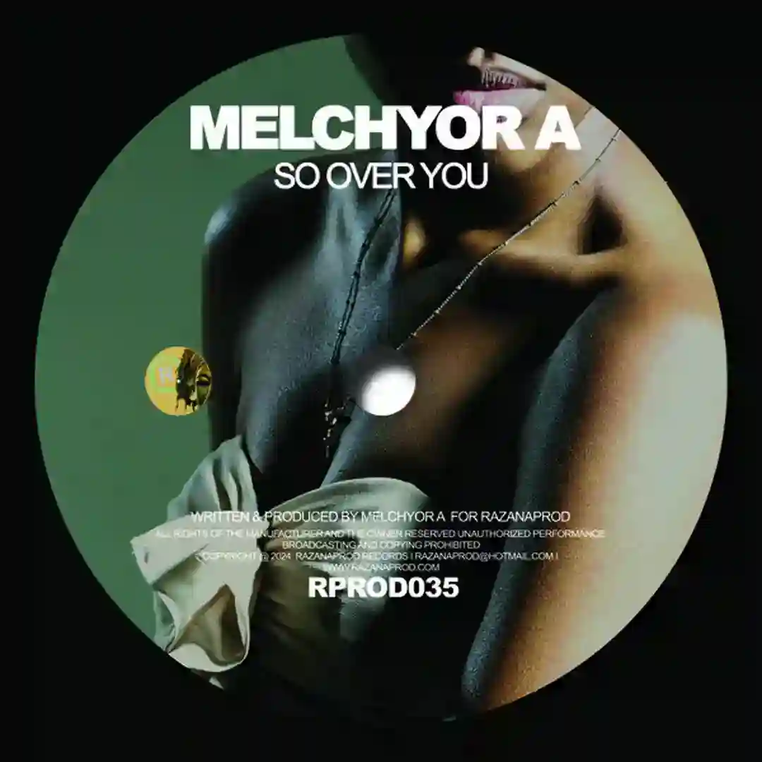 So Over You (Melchyor A's Hmida Version) cover
