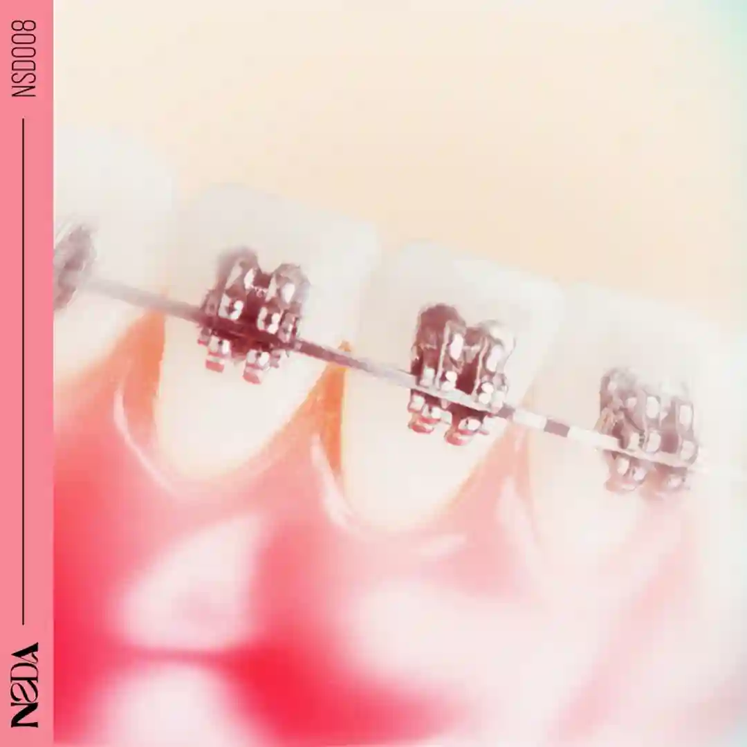 About U cover