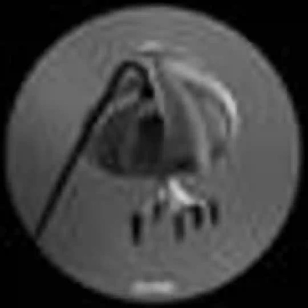 Headcrash (Holger Flinsch Rehash Cut) cover