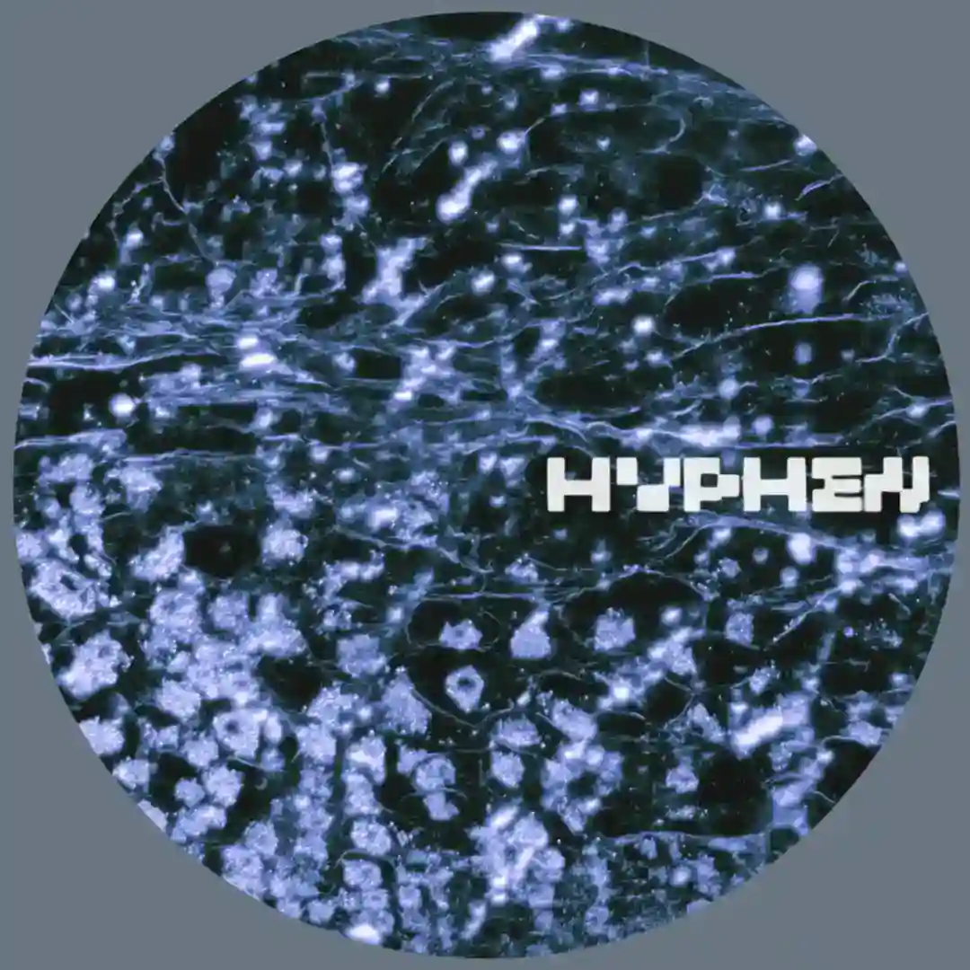 Historic Archetype (Forest on Stasys Remix) cover