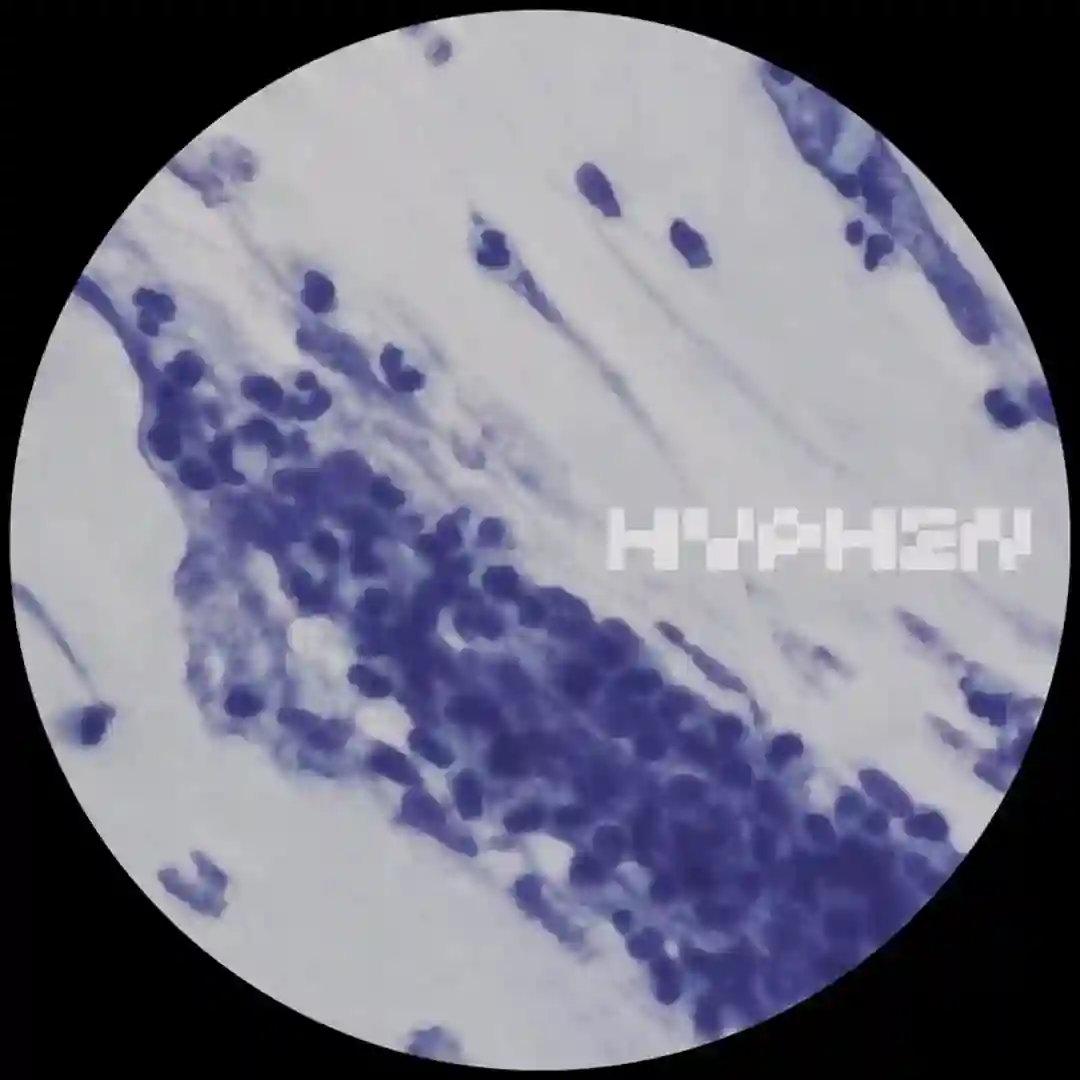 Hydrate (Rorschack Remix) cover
