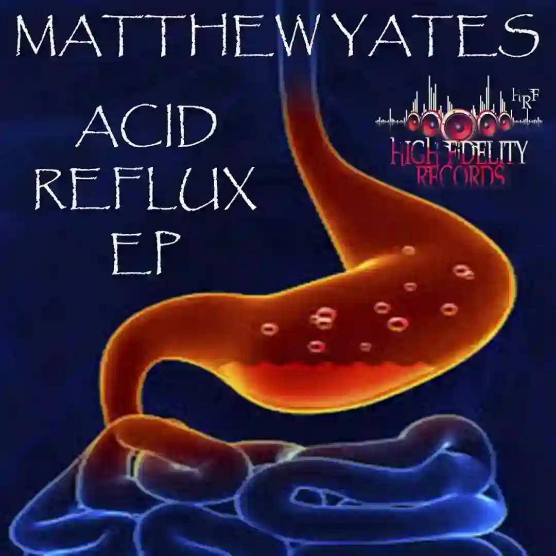 151 (Acid Remix 2) cover