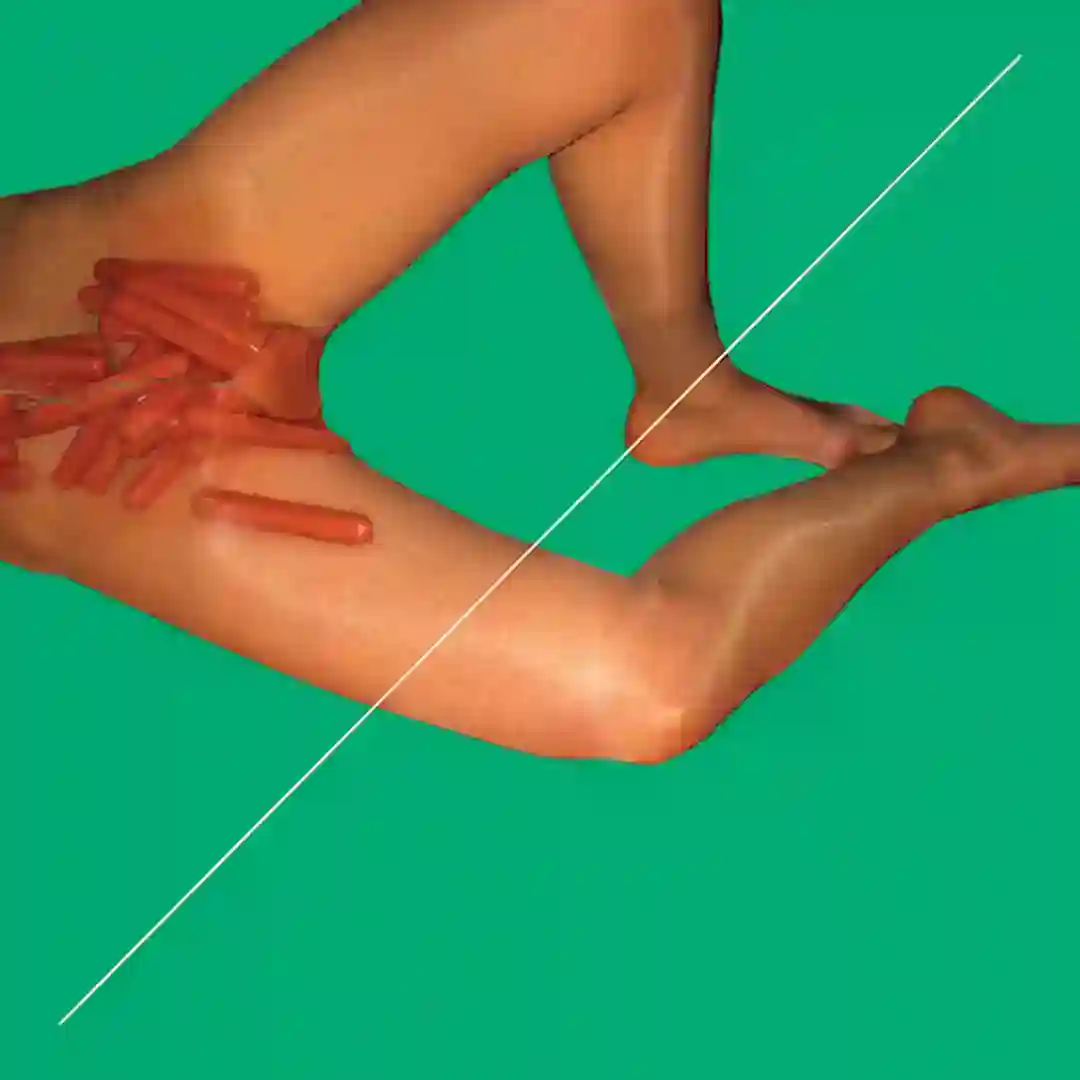 Light in Places (Kim Anh Stargasm Remix) cover