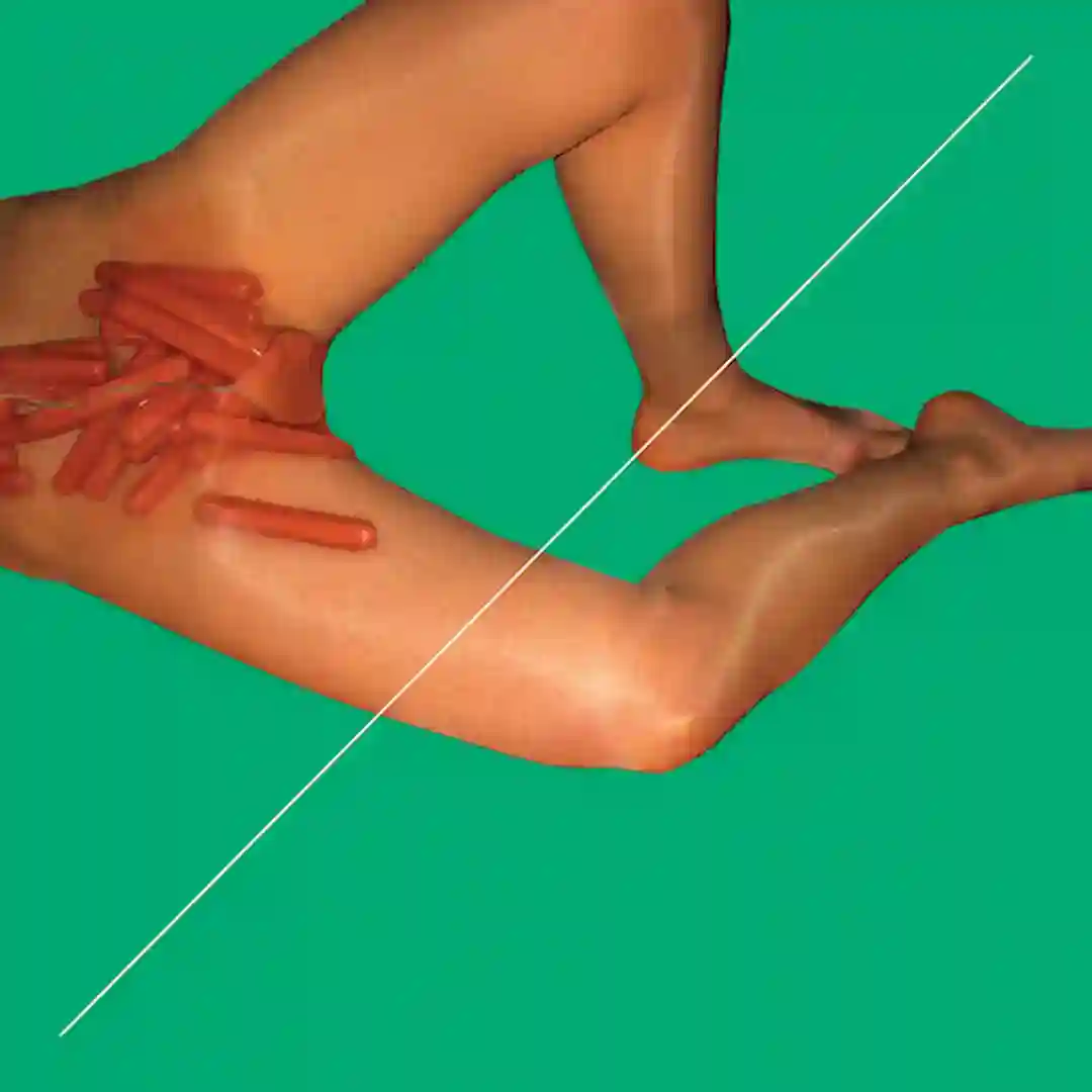 Vaginoplasty (Planningtorock Vagina Rework) cover