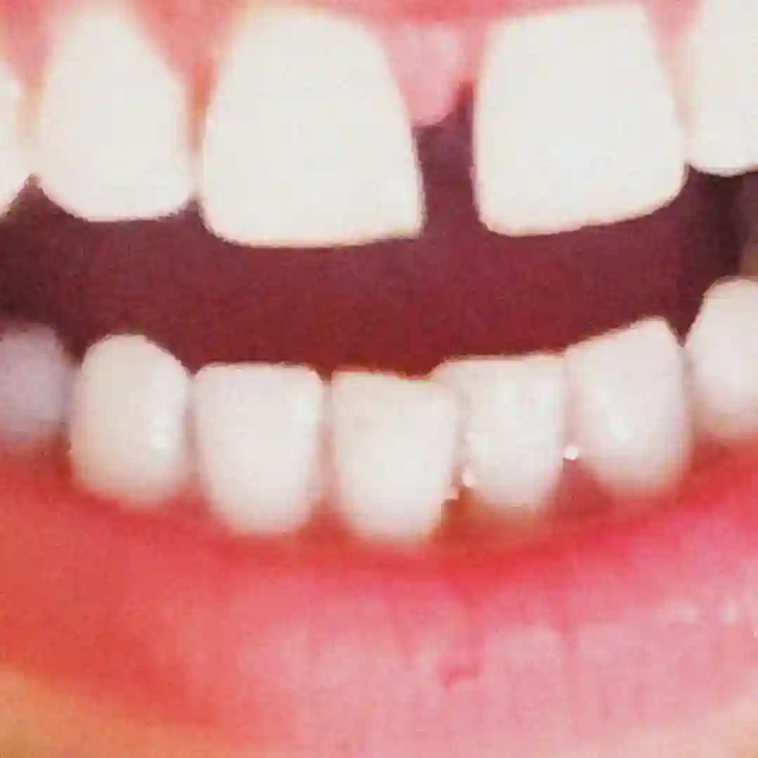 Oaoa cover
